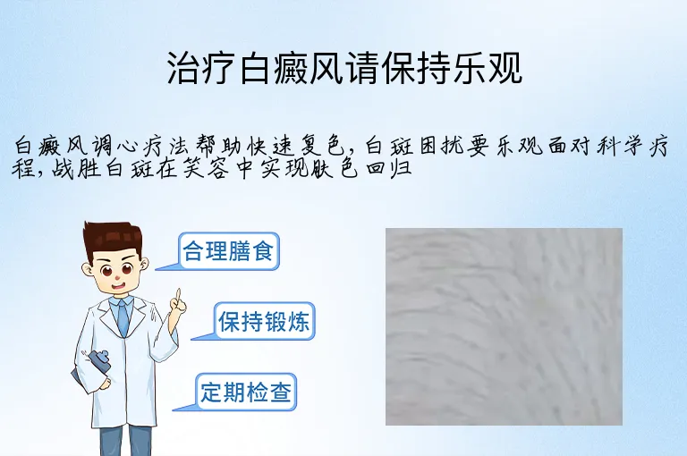 治疗白癜风请保持乐观