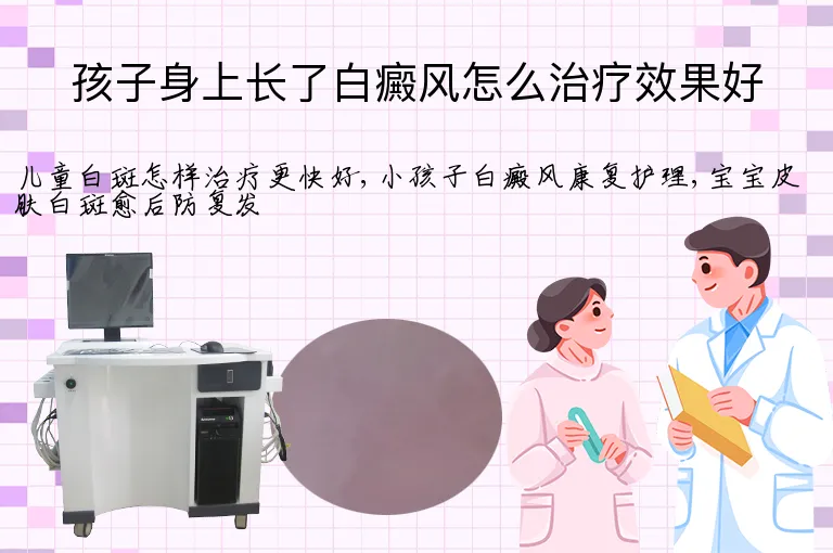 孩子身上长了白癜风怎么治疗效果好