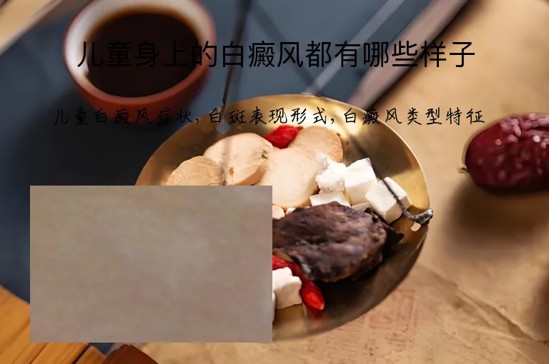 儿童身上的白癜风都有哪些样子