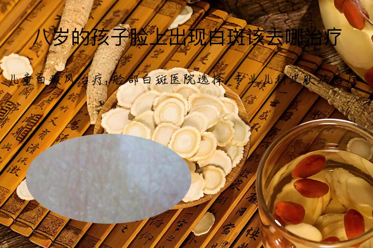 八岁的孩子脸上出现白斑该去哪治疗