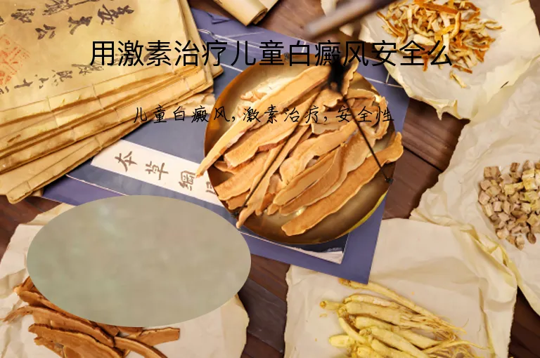用激素治疗儿童白癜风安全么