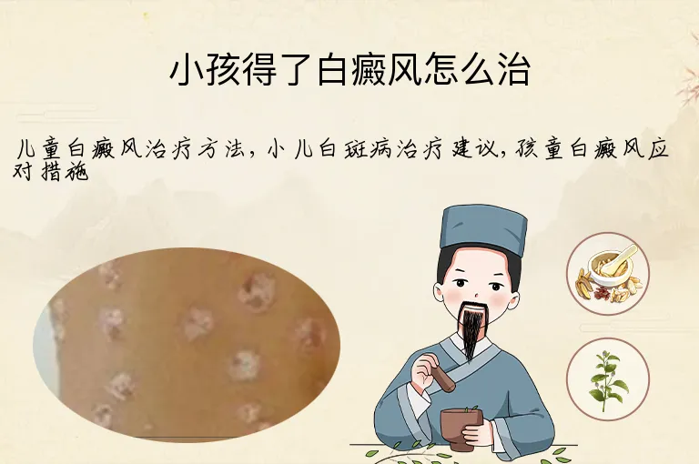 小孩得了白癜风怎么治