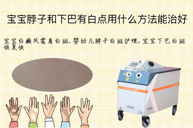 宝宝脖子和下巴有白点用什么方法能治好