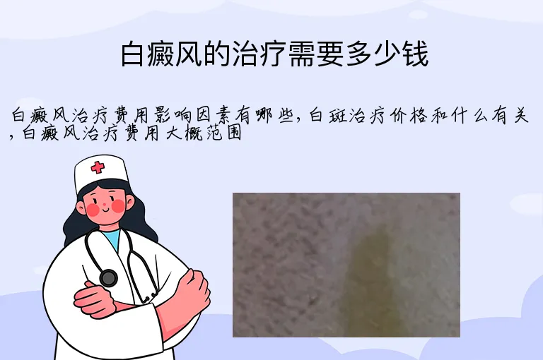 白癜风的治疗需要多少钱
