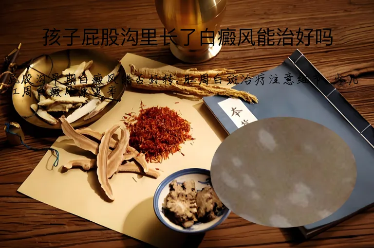 孩子屁股沟里长了白癜风能治好吗