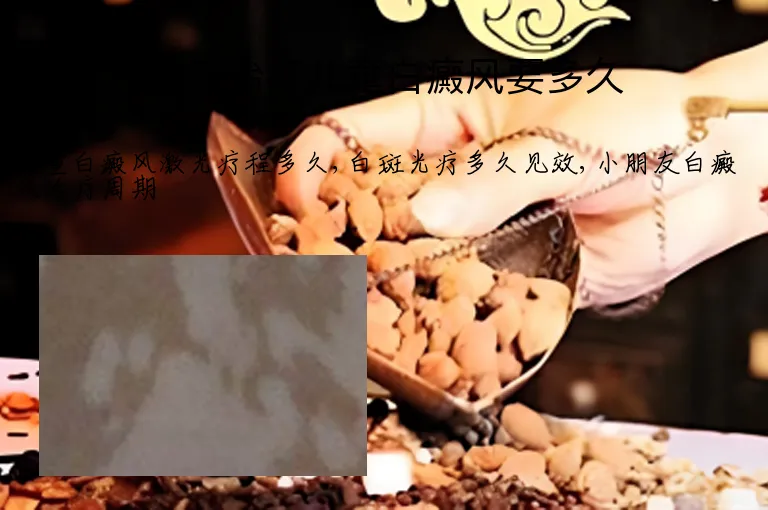 激光治疗儿童白癜风要多久