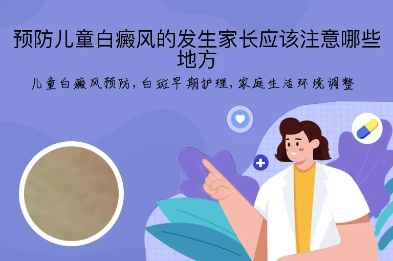 预防儿童白癜风的发生家长应该注意哪些地方
