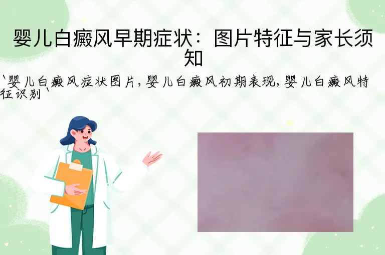 婴儿白癜风早期症状：图片特征与家长须知
