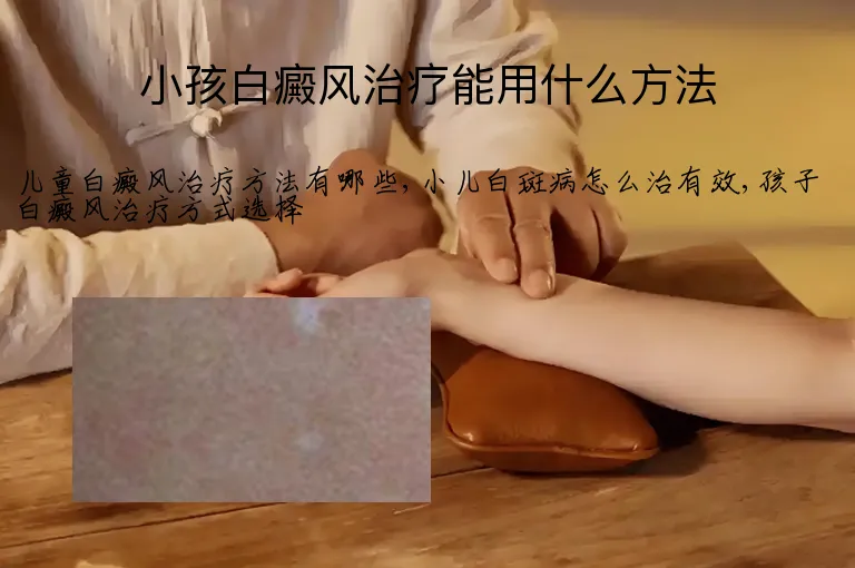 小孩白癜风治疗能用什么方法