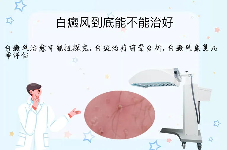 白癜风到底能不能治好