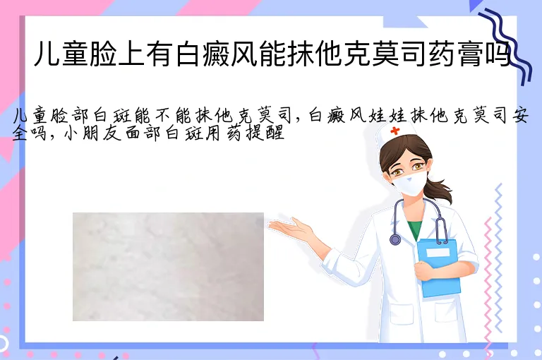 儿童脸上有白癜风能抹他克莫司药膏吗