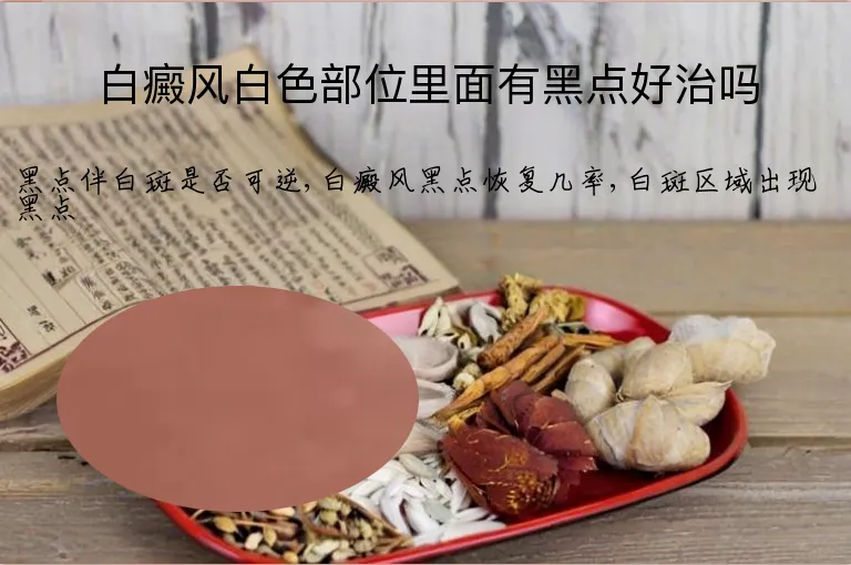 白癜风白色部位里面有黑点好治吗