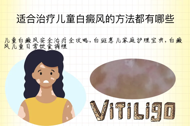 适合治疗儿童白癜风的方法都有哪些