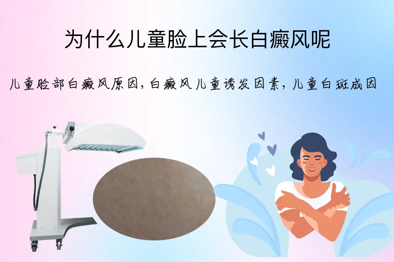 为什么儿童脸上会长白癜风呢