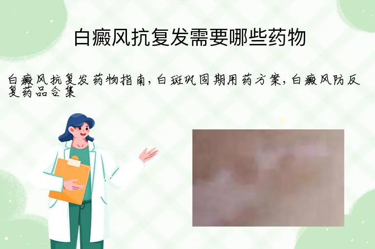 白癜风抗复发需要哪些药物