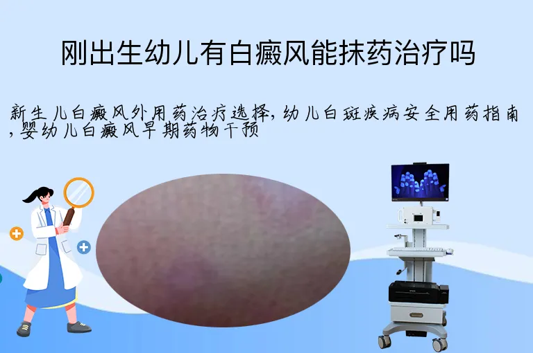 刚出生幼儿有白癜风能抹药治疗吗