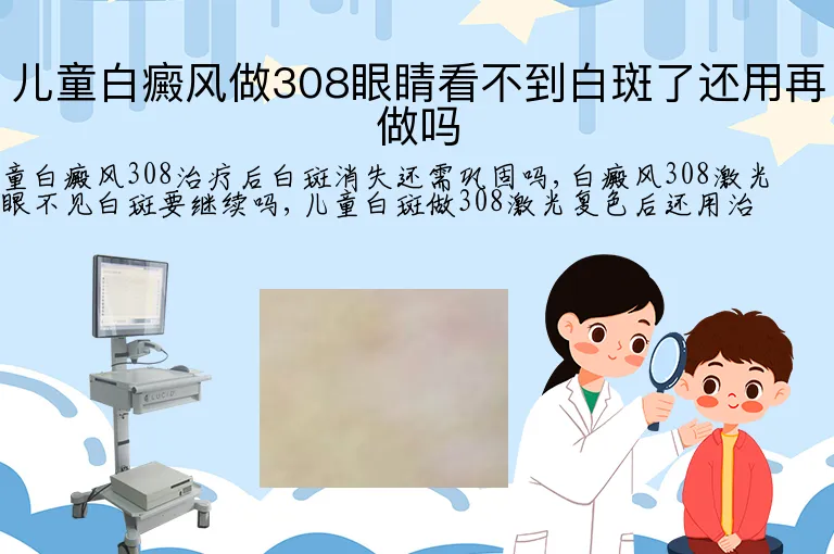 儿童白癜风做308眼睛看不到白斑了还用再做吗