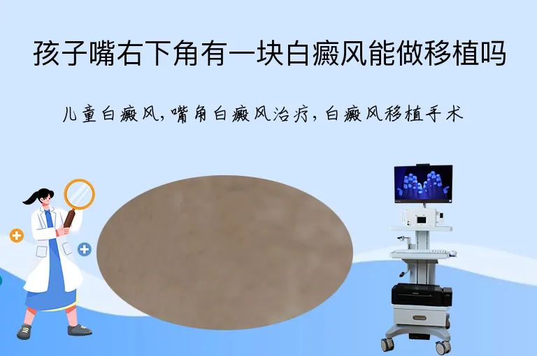 孩子嘴右下角有一块白癜风能做移植吗
