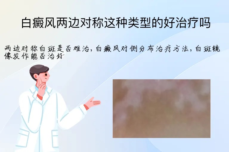 白癜风两边对称这种类型的好治疗吗