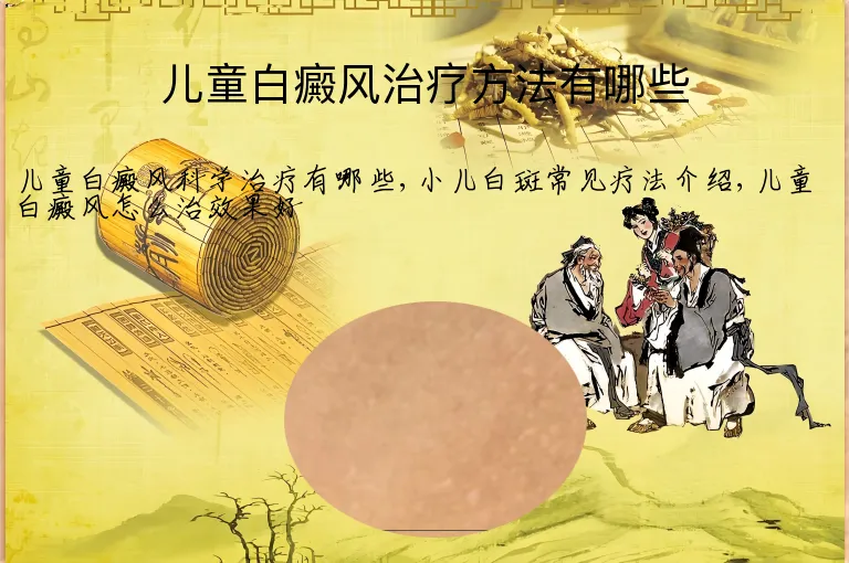 儿童白癜风治疗方法有哪些