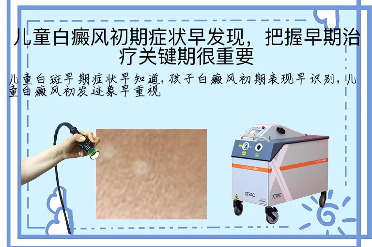 儿童白癜风初期症状早发现,把握早期治疗关键期很重要