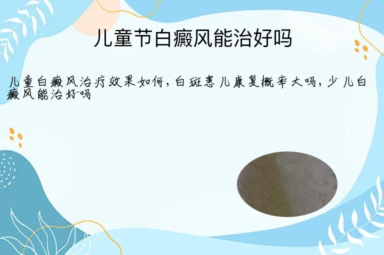 儿童节白癜风能治好吗