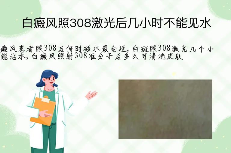 白癜风照308激光后几小时不能见水