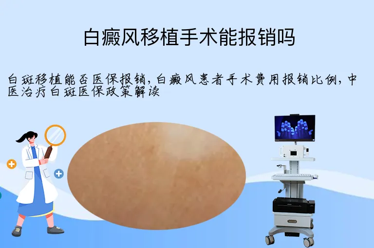 白癜风移植手术能报销吗