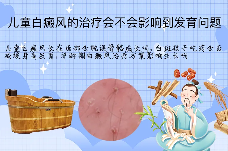 儿童白癜风的治疗会不会影响到发育问题