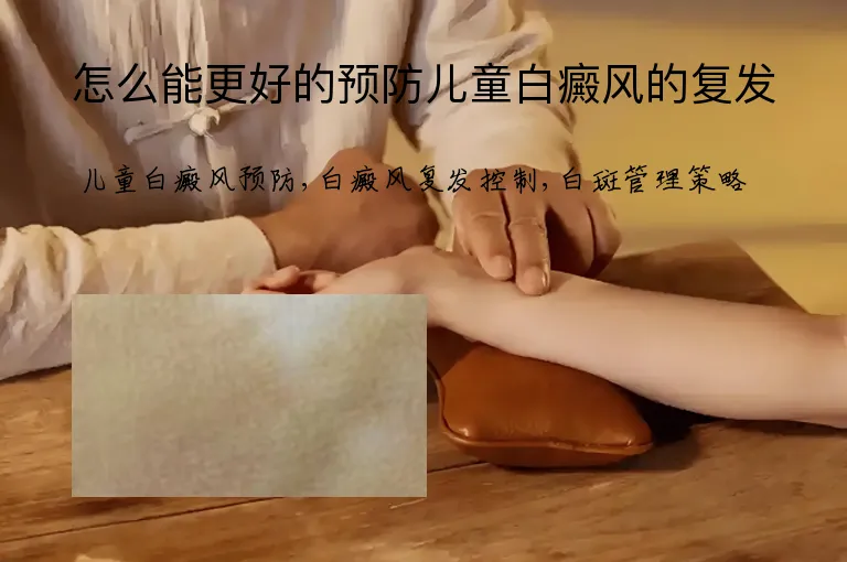 怎么能更好的预防儿童白癜风的复发