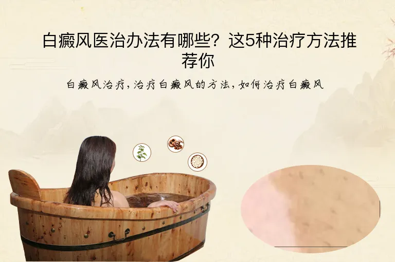 白癜风医治办法有哪些？这5种治疗方法推荐你