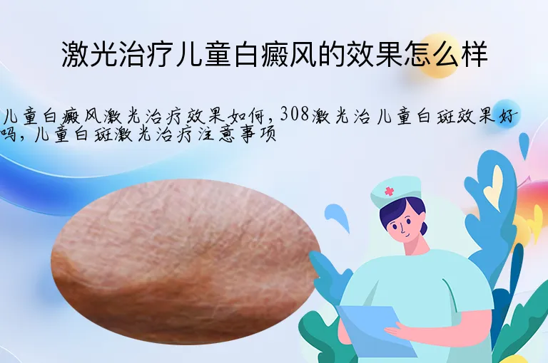 激光治疗儿童白癜风的效果怎么样
