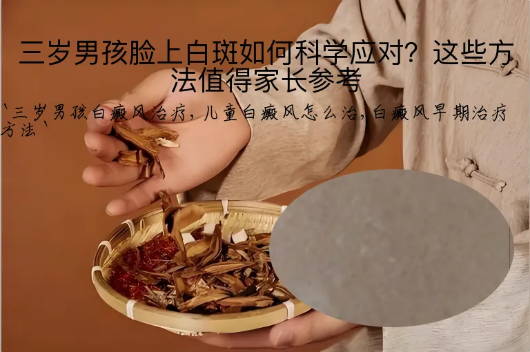 三岁男孩脸上白斑如何科学应对？这些方法值得家长参考
