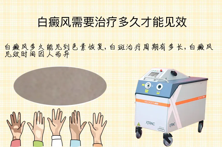 白癜风需要治疗多久才能见效