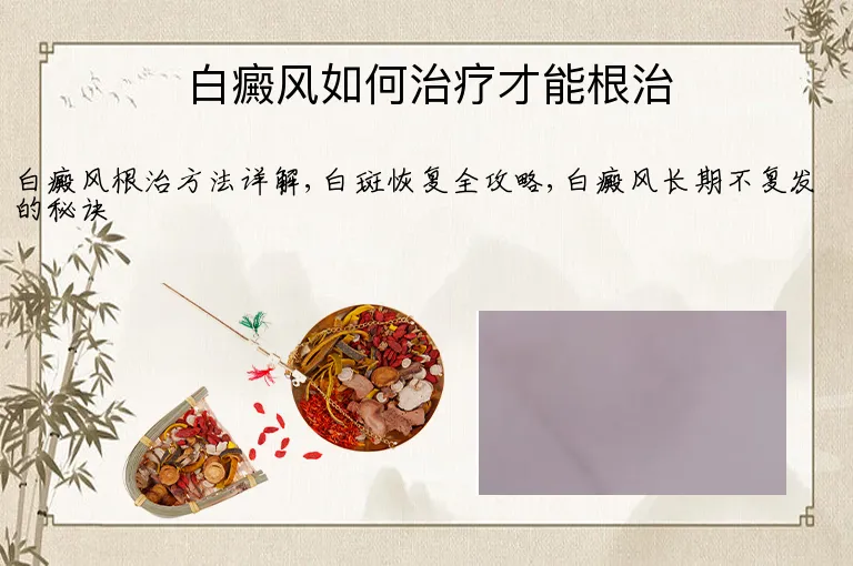 白癜风如何治疗才能根治