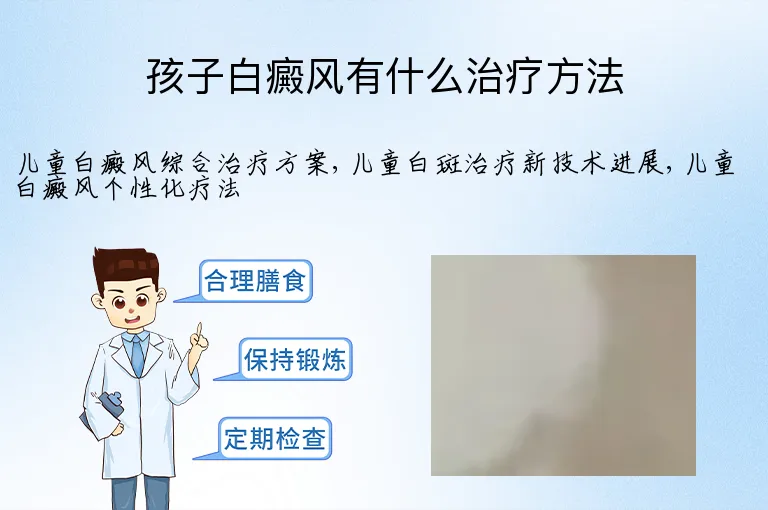 孩子白癜风有什么治疗方法