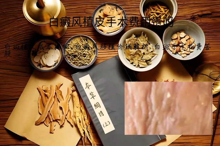 白癜风植皮手术费用贵吗