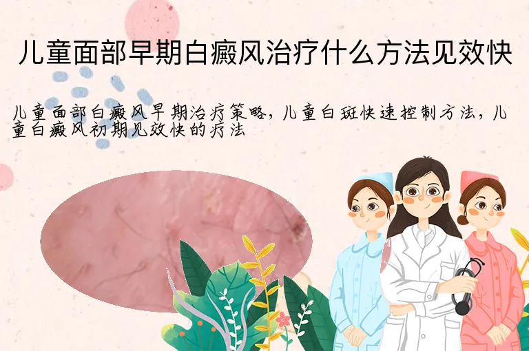 儿童面部早期白癜风治疗什么方法见效快