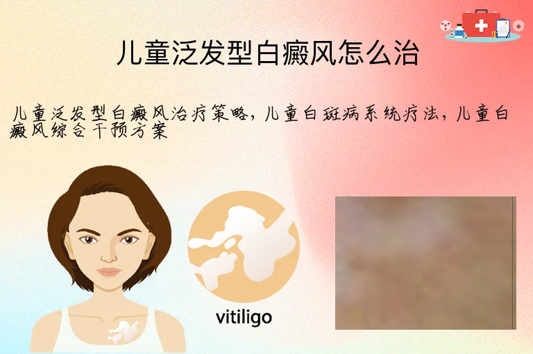 儿童泛发型白癜风怎么治