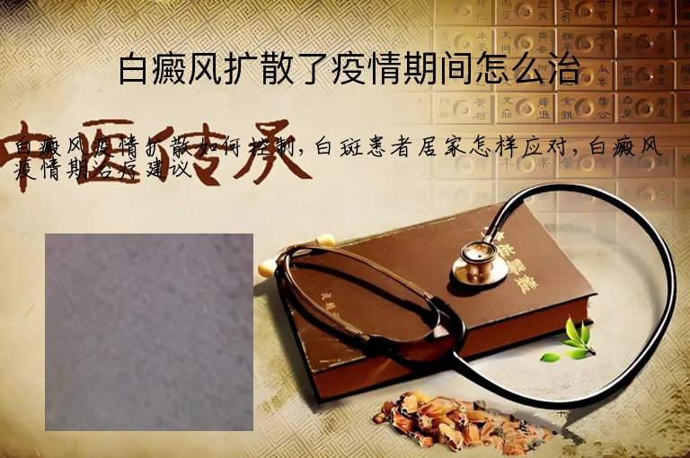 白癜风扩散了疫情期间怎么治