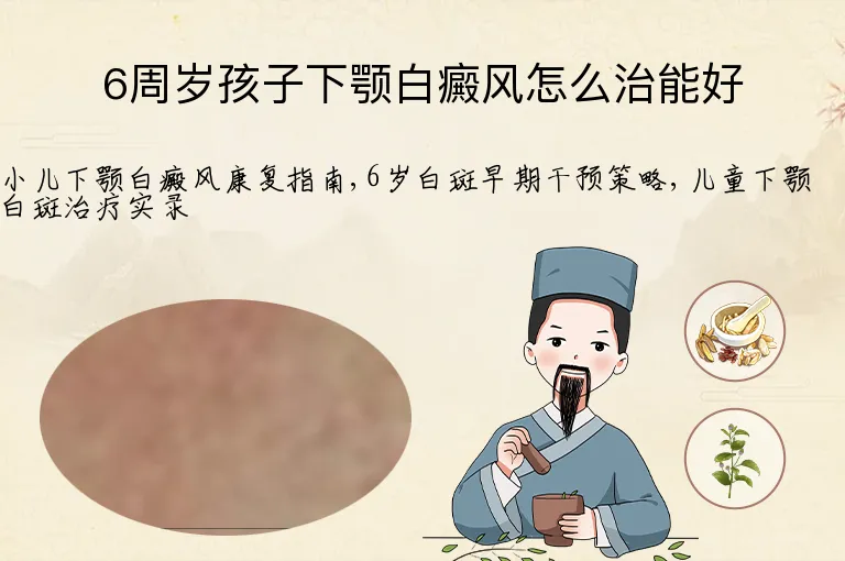 6周岁孩子下颚白癜风怎么治能好