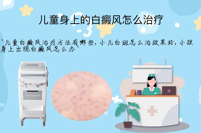 儿童身上的白癜风怎么治疗