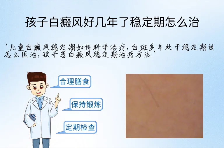 孩子白癜风好几年了稳定期怎么治