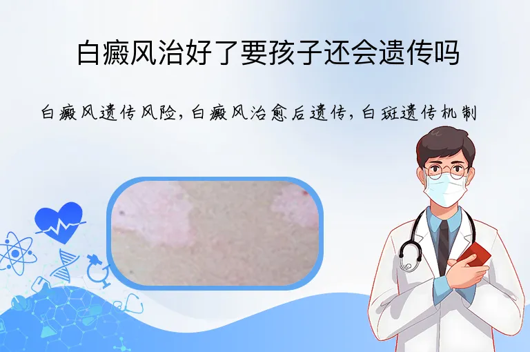 白癜风治好了要孩子还会遗传吗