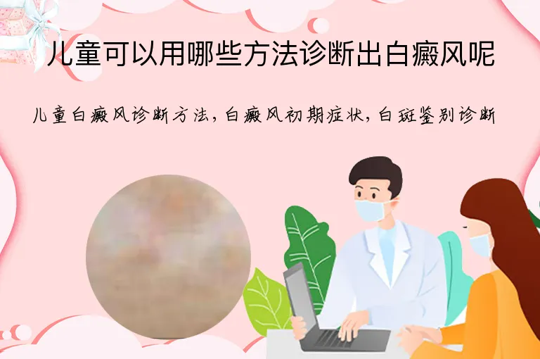 儿童可以用哪些方法诊断出白癜风呢