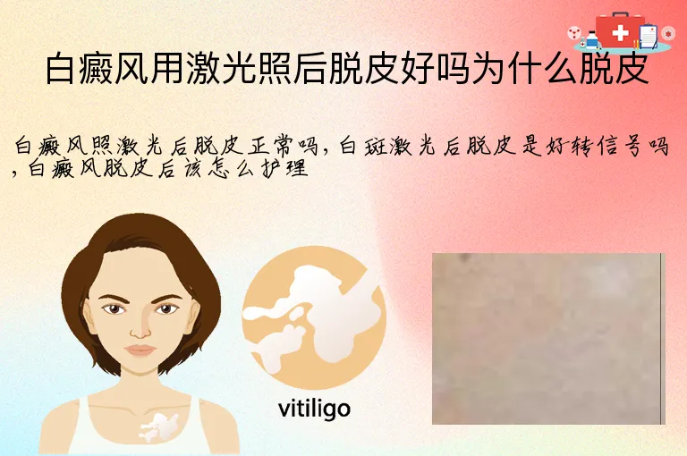 白癜风用激光照后脱皮好吗为什么脱皮