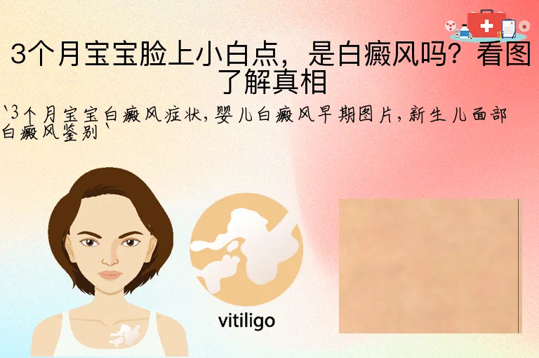 3个月宝宝脸上小白点，是白癜风吗？看图了解真相
