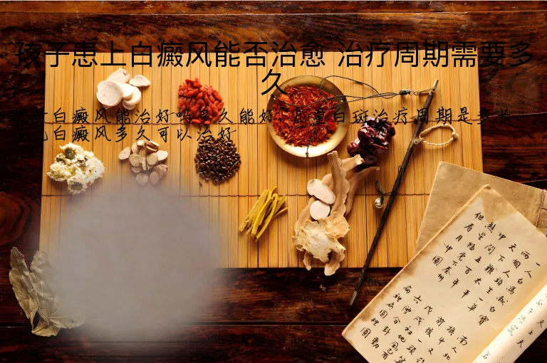 孩子患上白癜风能否治愈 治疗周期需要多久