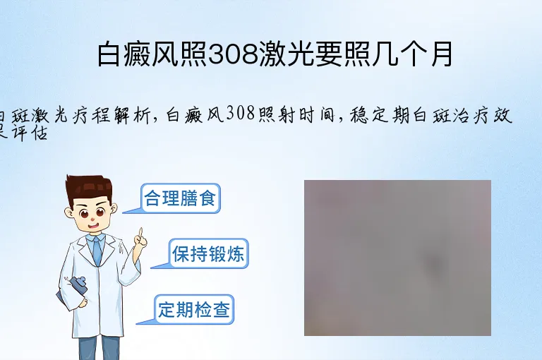 白癜风照308激光要照几个月