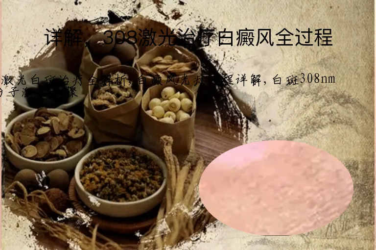 详解，308激光治疗白癜风全过程